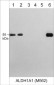 Anti-ALDH1A1 (N-terminal region) Antibody