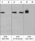 Anti-ATM (C-terminal region) Antibody