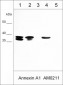 Anti-Annexin A1 Antibody