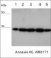 Anti-Annexin A5 Antibody