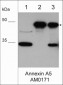 Anti-Annexin A5 Antibody