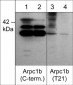 Anti-Arpc1b/p41-Arc (Thr-21), Phosphospecific Antibody