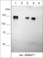 Anti-Axl/UFO (Extracellular region) Antibody