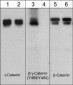 Anti-β-Catenin (Tyr-489) [γ-Catenin (Tyr-480)], Phosphospecific Antibody