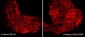 Anti-β-Catenin (Tyr-489) [γ-Catenin (Tyr-480)], Phosphospecific Antibody