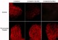 Anti-β-Catenin (Tyr-654) [γ-Catenin (Tyr-644)], Phosphospecific Antibody