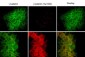 Anti-γ-Catenin (Tyr-550), Phosphospecific Antibody