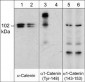Anti-α1-Catenin (Tyr-148), Phosphospecific Antibody