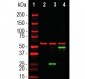 Anti-SARS-CoV-2 S-Protein ACE2 Binding Domain Antibody