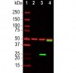 Anti-SARS-CoV-2 S-Protein ACE2 Binding Domain Antibody