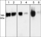Anti-EGFR (Ser-1142), Phosphospecific Antibody