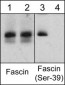 Anti-Fascin (Ser-39), Phosphospecific Antibody