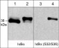 Anti-IκBα (Ser-32/Ser-36), Phosphospecific Antibody