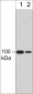 Anti-Integrin β3 (Extracellular region) Antibody