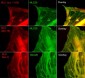 Anti-Myosin Light Chain (N-terminal region) Antibody