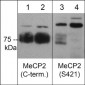 Anti-MeCP2 (Ser-421), Phosphospecific Antibody