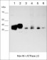 Anti-Na+/K+ ATPase β3 (Extracellular) Antibody