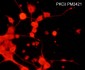 Anti-PKCδ (N-terminal region) Antibody