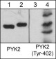 Anti-PYK2 (Tyr-402), Phosphospecific Antibody