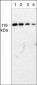 Anti-PYK2 (C-terminal region) Antibody