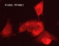 Anti-Profilin (C-terminal region) Antibody