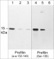 Anti-Profilin (C-terminal region) Antibody