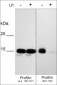 Anti-Profilin (Ser-138), Phosphospecific Antibody