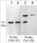 Anti-Profilin (Tyr-129), Phosphospecific Antibody