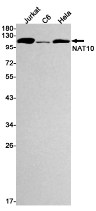 NAT10 Rabbit mAb