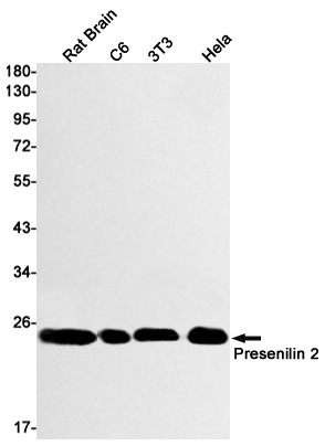 Presenilin 2 Rabbit mAb