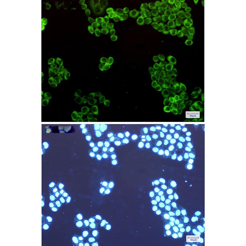Tryptophan tRNA Ligase Rabbit mAb