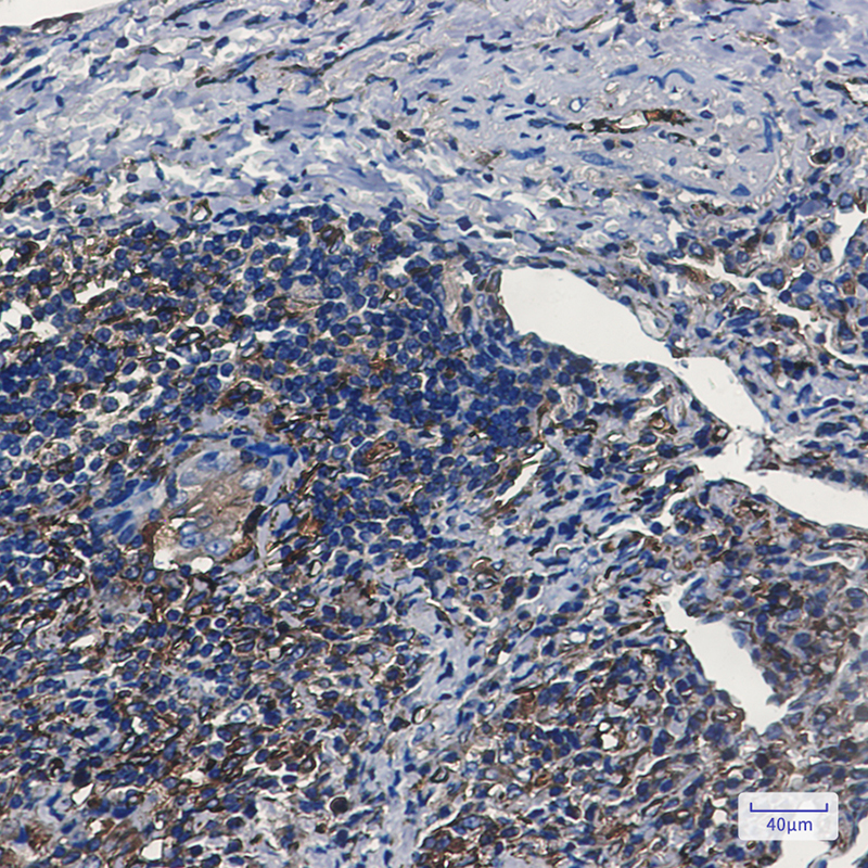 Tryptophan tRNA Ligase Rabbit mAb