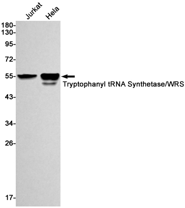 Tryptophan tRNA Ligase Rabbit mAb