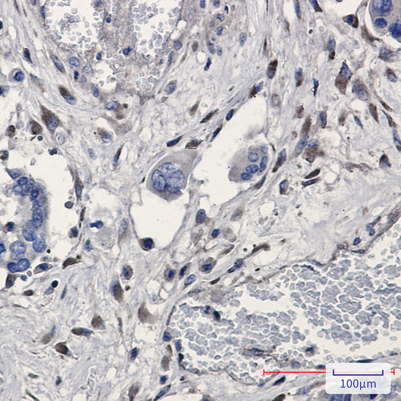 GNB2 Rabbit mAb