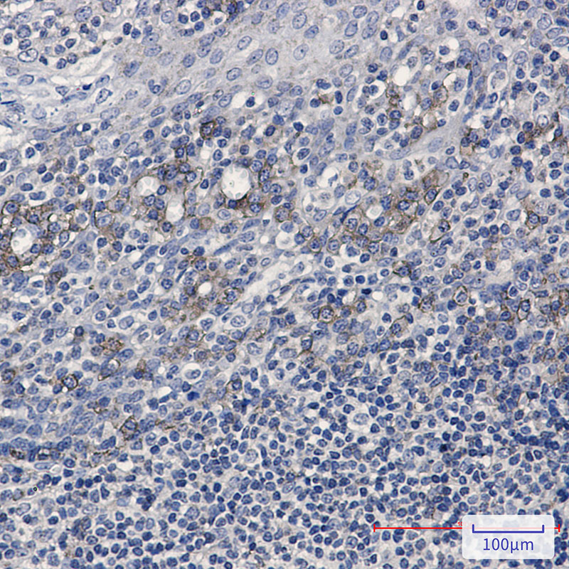 CD32B Rabbit mAb