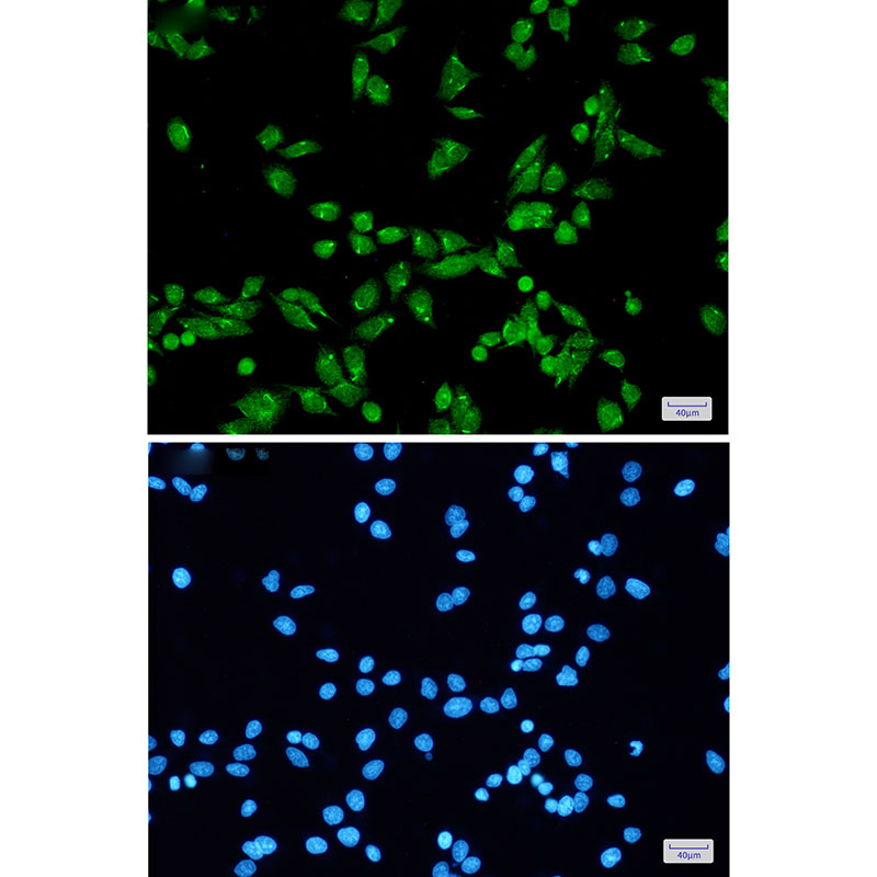 PRPF31 Rabbit mAb