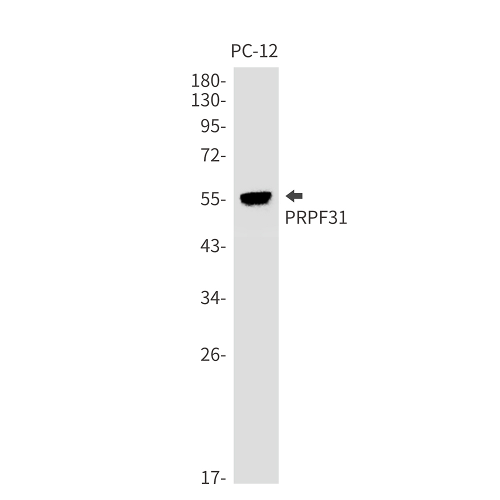 PRPF31 Rabbit mAb