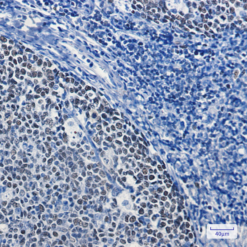 MCM5 Rabbit mAb