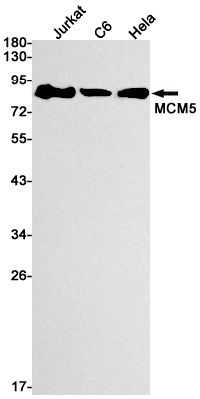 MCM5 Rabbit mAb