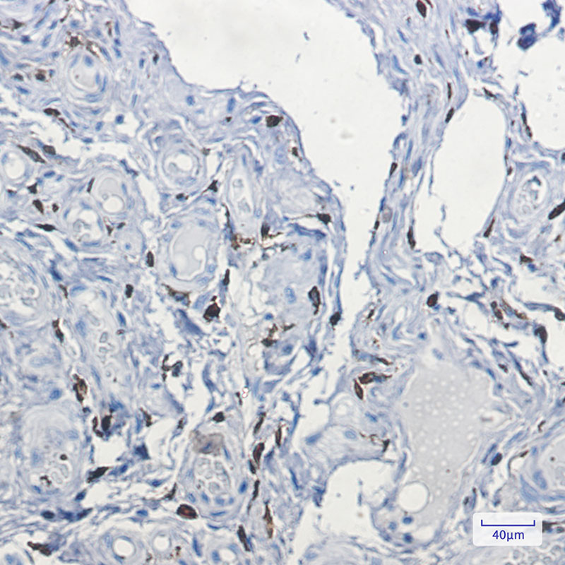 Factor XIIIa Rabbit mAb