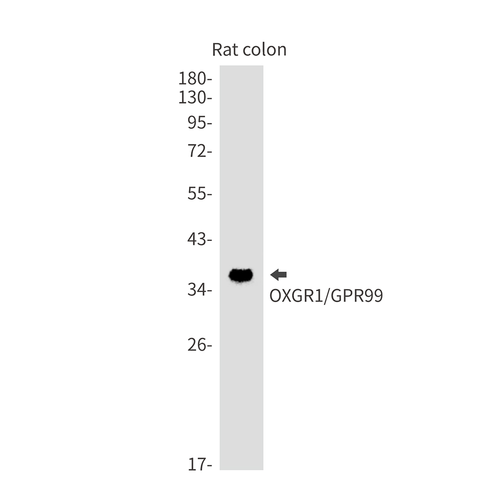OXGR1 Rabbit mAb
