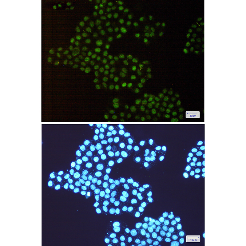 TRMT2A Rabbit mAb