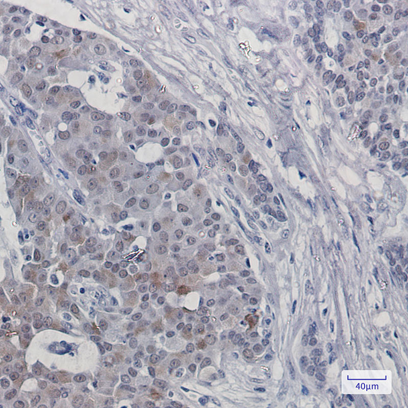 TRMT2A Rabbit mAb