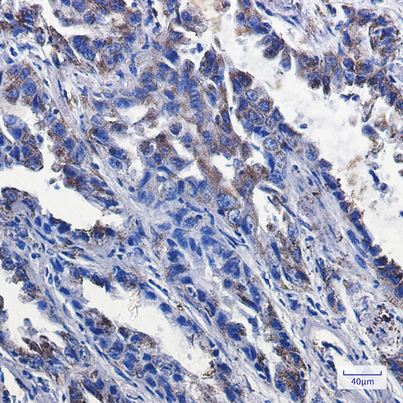 P2Y6 Rabbit mAb