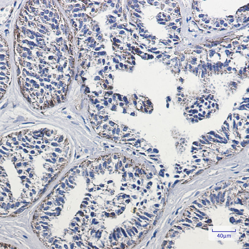 Lipoamide Dehydrogenase Rabbit mAb