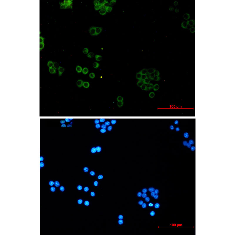 SNX5 Rabbit mAb