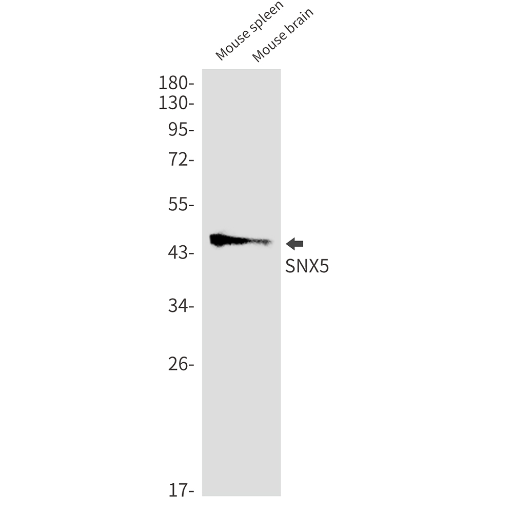 SNX5 Rabbit mAb