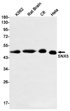 SNX5 Rabbit mAb