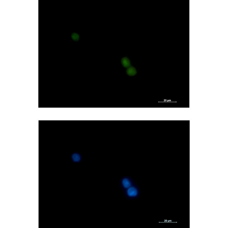 POLD1 Rabbit mAb