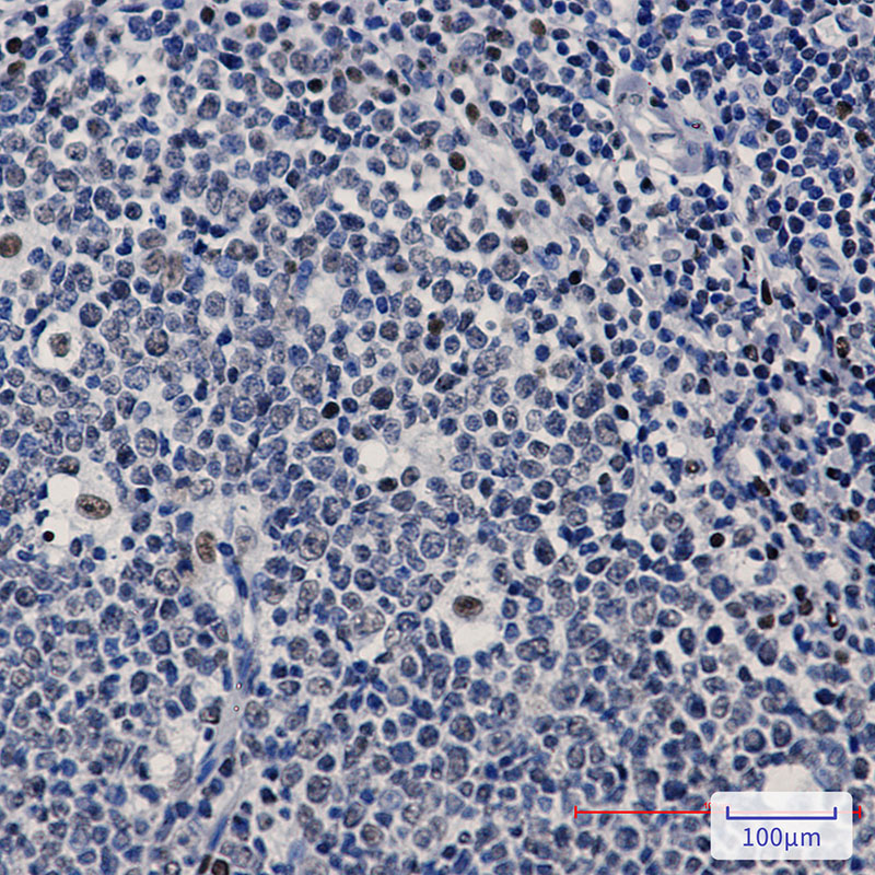 PREB Rabbit mAb